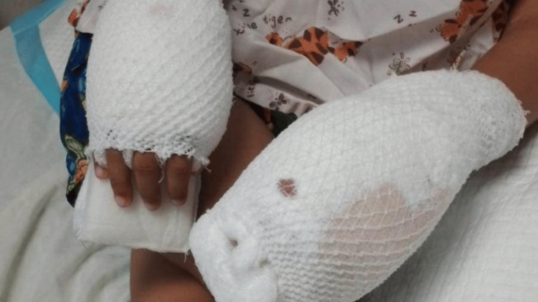 Imputada de Maltrato Infantil Recibe Prisión Preventiva Tras Causar Quemaduras a Su Hijo de Cuatro Años - Imagen