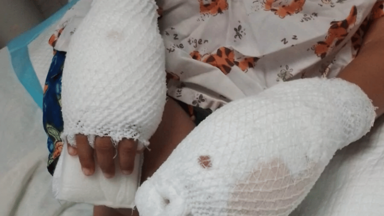 Aplazan nuevamente audiencia de medida de coerción contra madre acusada de quemar manos de su hijo - Imagen