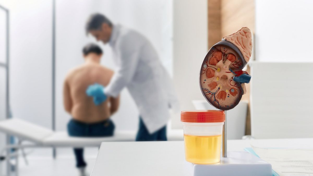 Innovación transforma el panorama de pacientes  con cáncer renal - Imagen